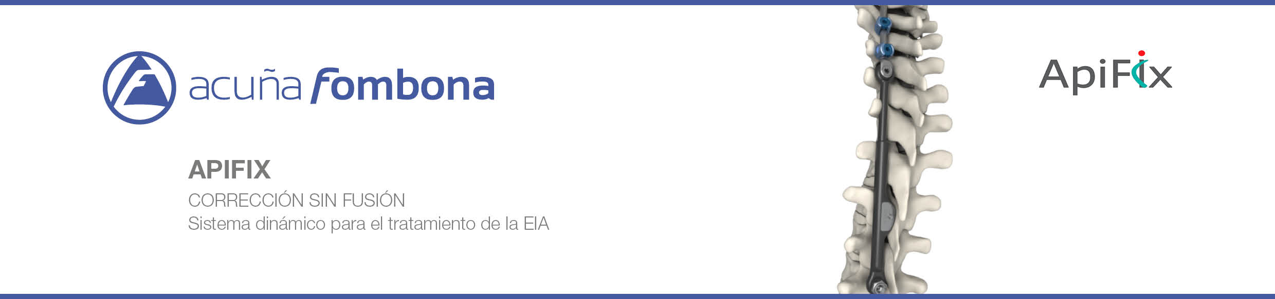 Acuña y Fombona