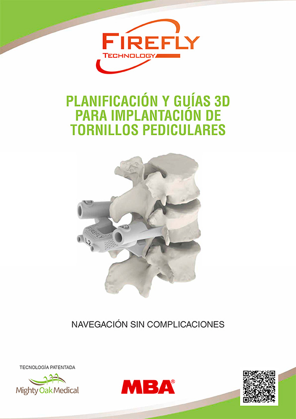 PLANIFICACIÓN Y GUIAS 3D PARA IMPLANTACIÓN DE TORNILLOS PEDICULARES