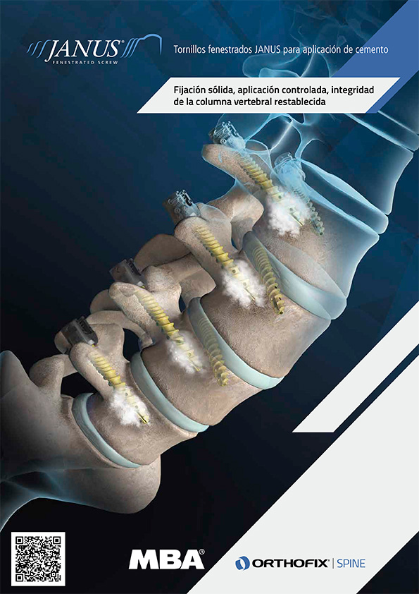 TORNILLOS FENESTRADOS JANUS