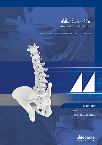MY SPINE S2AL