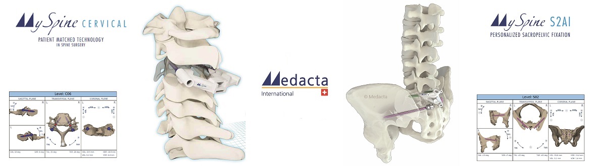 MY SPINE CERVICAL